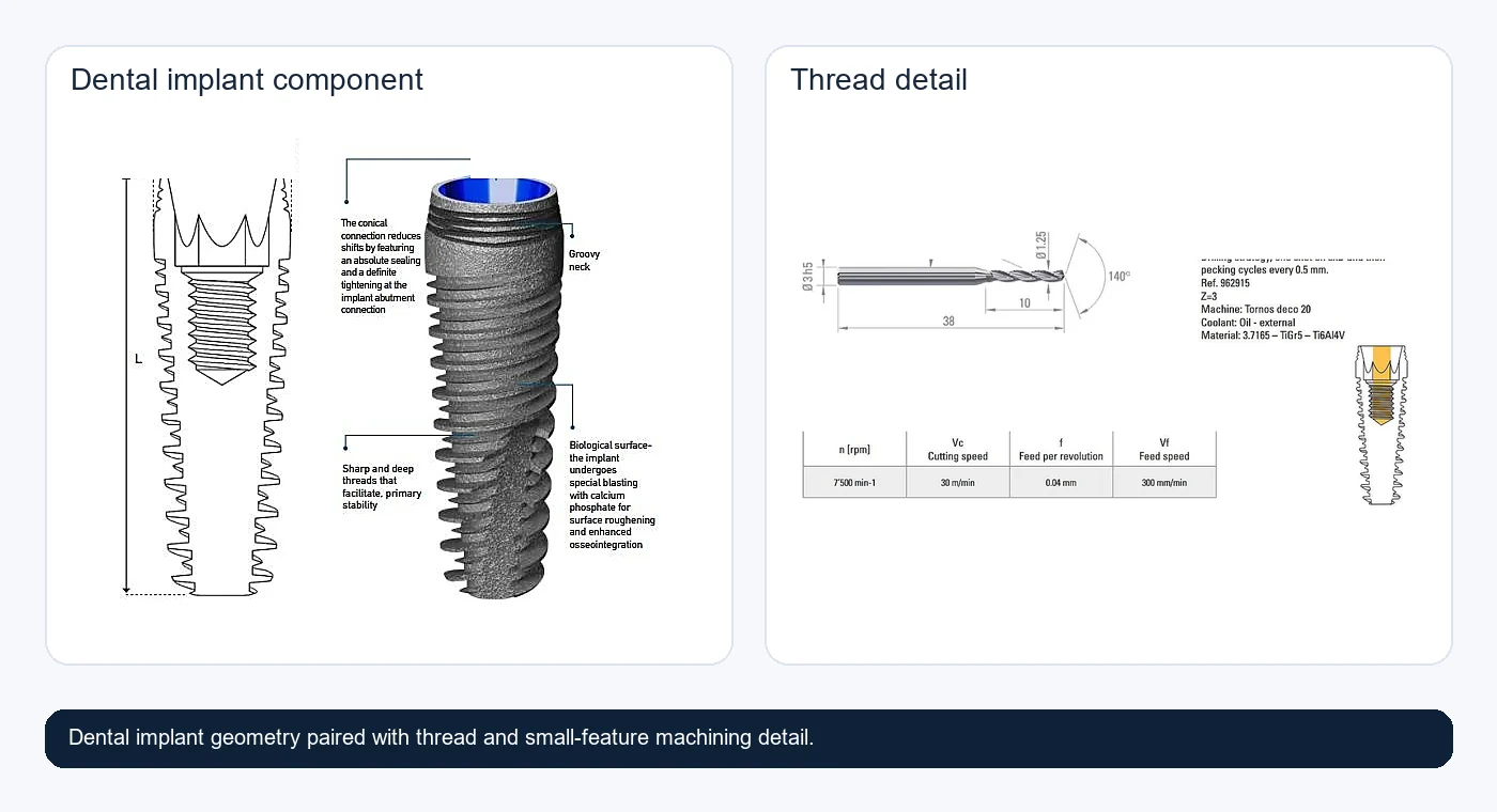 Dental implant and thread detail